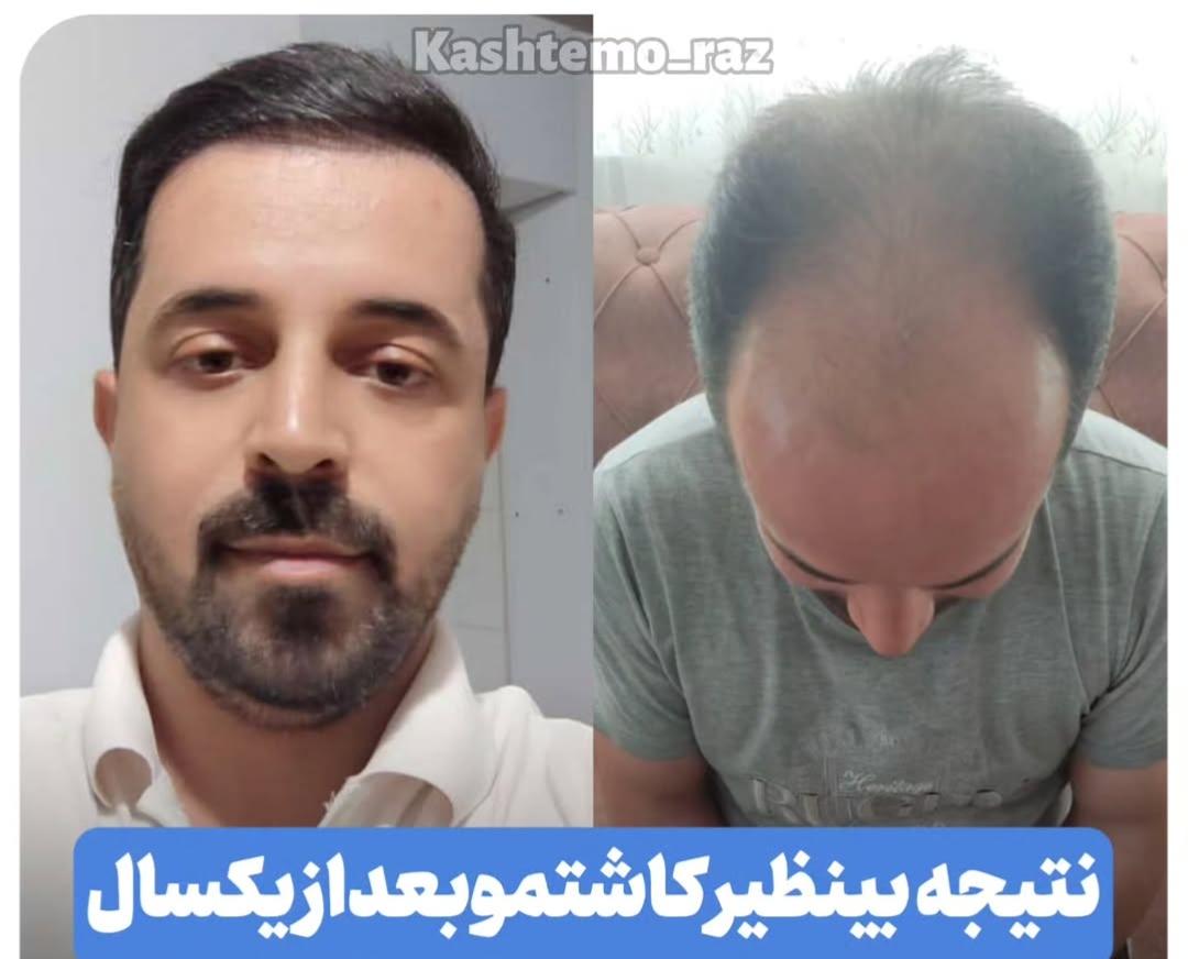 مراقبت‌های بعد از عمل