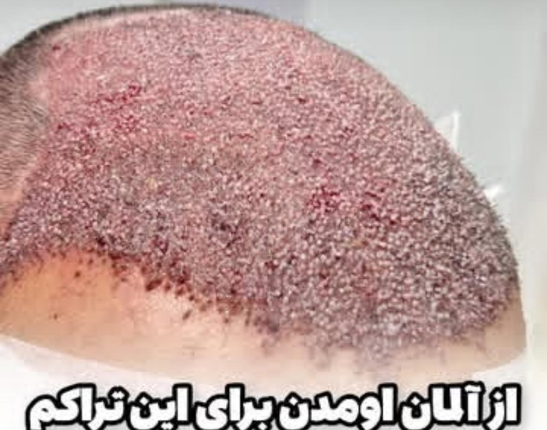 استفاده از دستگاه‌های پیشرفته