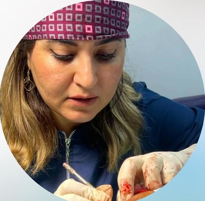 کاشت مو راز در شیراز